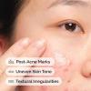 imageThe Ordinary Aloe 2  NAG 2 Solution Soothes Skin and Targets PostAcne Marks 1 Fl Oz