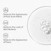 imageThe Ordinary Aloe 2  NAG 2 Solution Soothes Skin and Targets PostAcne Marks 1 Fl Oz