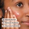 imageThe Ordinary Soothing ampamp Barrier Support Serum RednessReducing ampamp Hydrating Solution for Skin Barrier Recovery1 Fl Oz Pack of 1